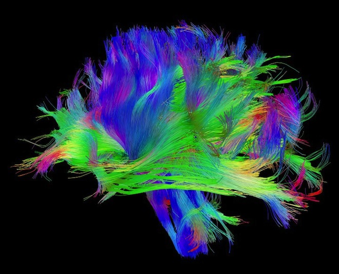 serious-brain